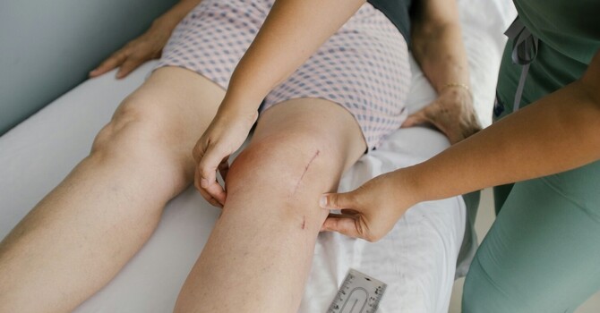Scar Tissue After Surgery: Why Movement Matters More Than "Breaking It Up"
